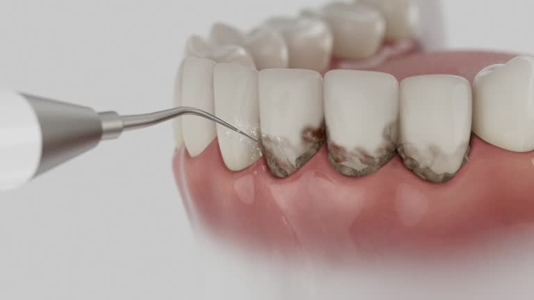 Reliable Invisalign Clear Aligners contractor in McClain County County, OK by Dentist Open Now